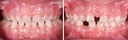 Bioactivador Modelo TC — caso clínico antes y después