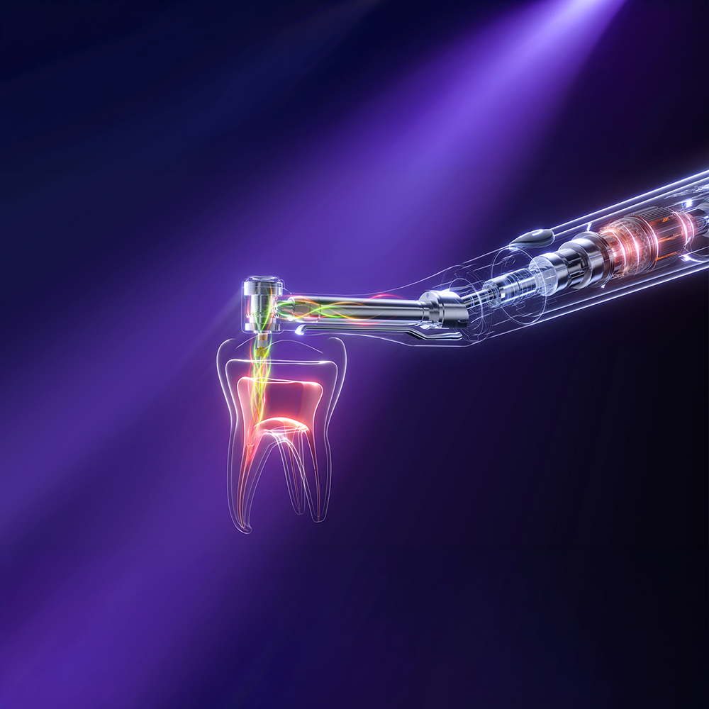 ENDO GT PRO | Motor de endodoncia Woodpecker