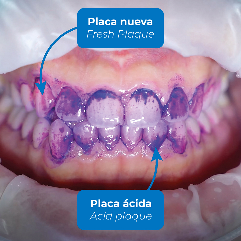 Revelador de Biofilm Discloser P Woodpecker | 15 ml