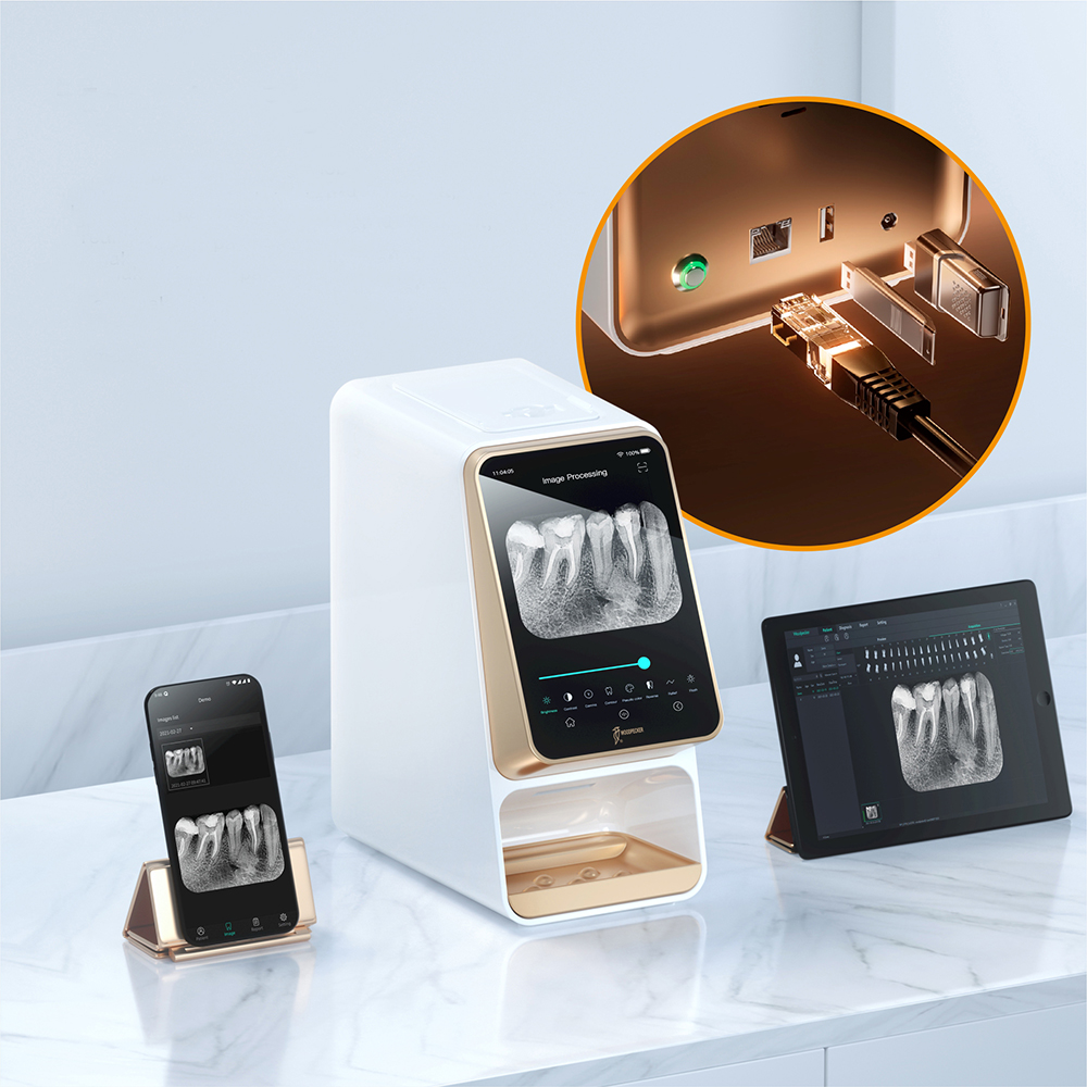 Escáner placas fósforo i-Scan UPGRADE WOODPECKER. Digitalización dental rápida.