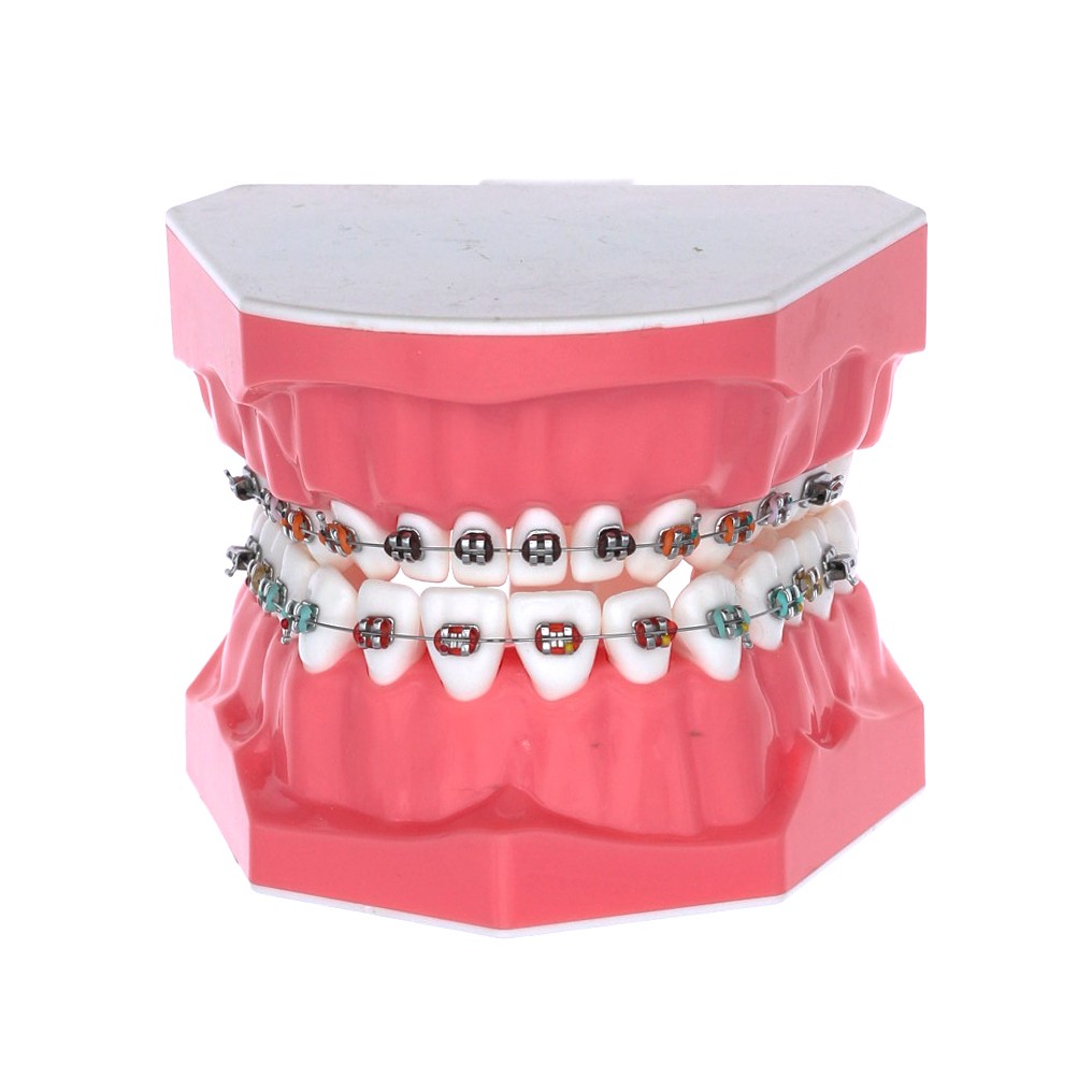 Tipodonto MASTER adulto con brackets, 32 dientes para demostración.