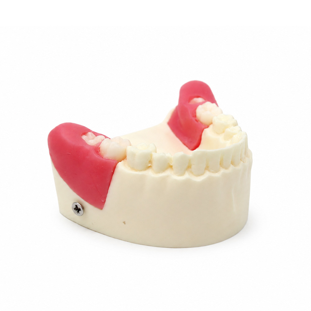 Modelo de Extracción de Dientes Retenido y Semiretenido