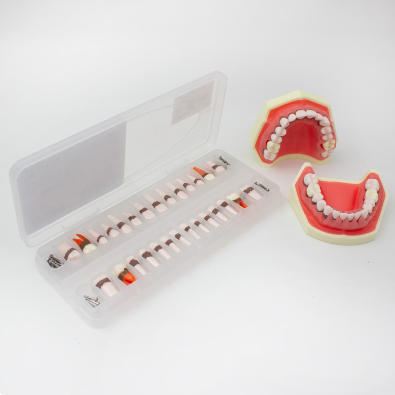 Reposición de Dientes para Tipodonto de Periodoncia