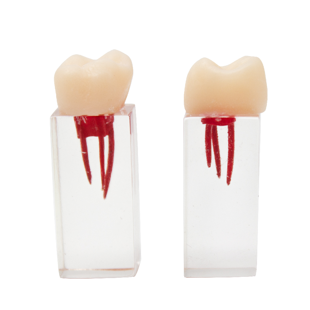 Molar para Endodoncia