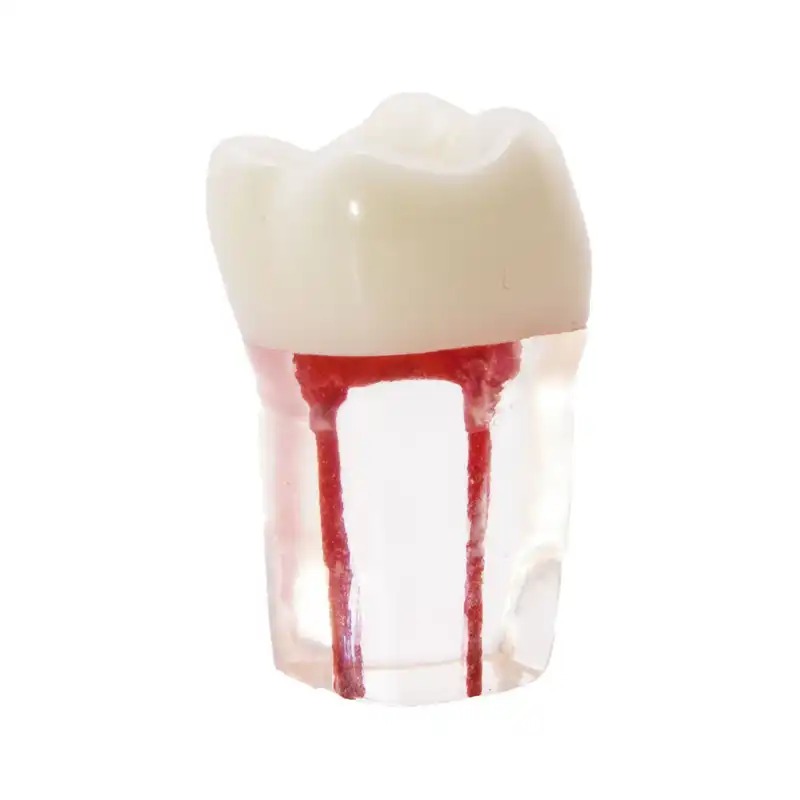 Molar con Conductos Radiculares