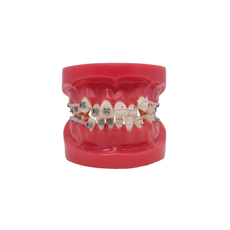 Modelo de Bracket Metálico y zafiro