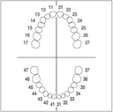 Juego 28 dientes Frasaco ANA-4 Z con tornillos (adulto)