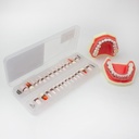 Reposición de Dientes para Tipodonto de Periodoncia