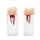 Molar para Endodoncia