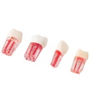 Set de Dientes Transparentes para Endodoncia