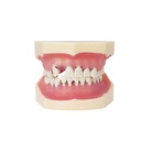 Modelo de periodoncia