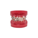 Modelo de Bracket Metálico y zafiro